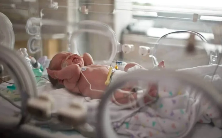 High-risk-infant-follow-up-clinic